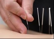Practical Dry Needling Level Two - Integrating Cervical, Lumbar, Extremities and Neurological Conditions